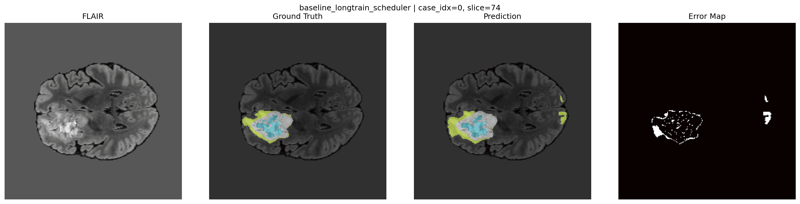 Baseline prediction example for comparison