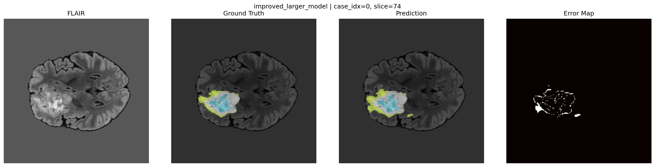Improved Larger U-Net qualitative prediction example